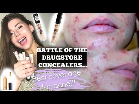 THE BEST ACNE COVERAGE CONCEALER IN THE DRUGSTORE, the winner is... || NYX, Elf, Essence, Covergirl