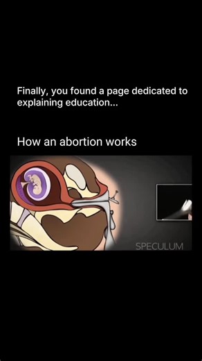 Explaining Education on Instagram: "An abortion is a medical procedure used to end a pregnancy. It can be done in two main ways: medication abortion, where prescribed pills are used to stop the pregnancy and cause the uterus to empty, and procedural abortion, where a trained doctor gently removes the pregnancy tissue from the uterus using safe medical instruments. Both methods are designed to be medically supervised, effective, and safe when done in a proper healthcare setting. After the procedu