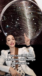 10K reactions · 1.3K shares | LA CASPA  que es y cómo deshacerte de...