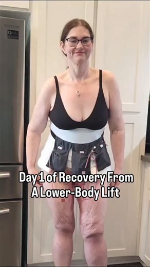 So far, so good! Day 1 of recovery went well. I'm listening to my body and taking it easy while still following my surgeon's instructions in regard to movement. Pain management is going well, too. I can go about 5 hours before I get really uncomfortable and have to take something. I don't NEED to walk anymore, but it's nice to have just in case. My husband has been the ABSOLUTE BEST during this whole process, I'm one lucky girl! #plasticsurgery #lowerbodylift #looseskin #excessskinremoval #exces