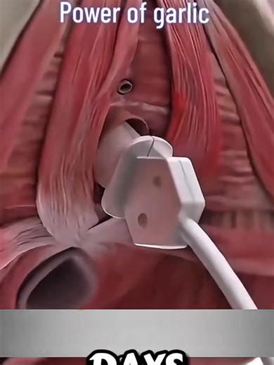 Amazing Health Benefits of Eating Garlic Daily