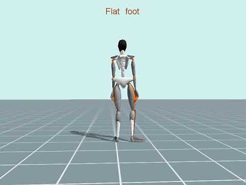 Flatfoot Walking