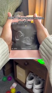 It’s customizable video sphere to replay your most cherished memories 🥹❤️ #pregnancygift #pregnant #pregnancy #ultrasound | Memory Sphere