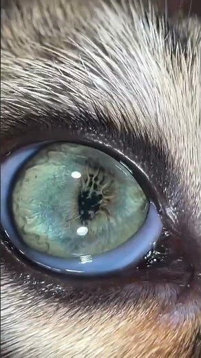 PPMs (persistent pupillary membranes) captured by QuikVue adaptor