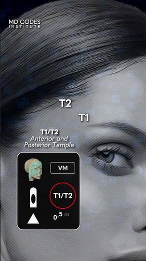 T1/T2 - MD Codes Review