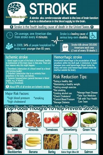 Top Foods That Help Prevent Stroke