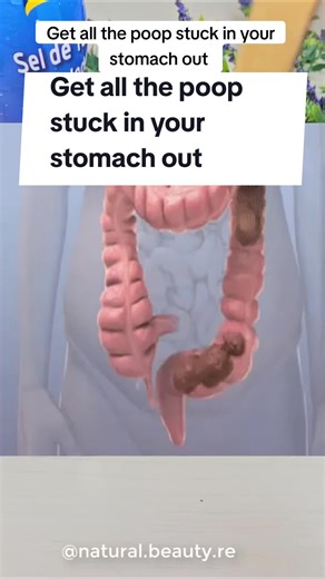 Get all the poop stuck in your stomach out. #usa_tiktok #usa🇺🇸 #recipe #recipes #poop #fart #farting #healthtips #recipesforyou #brazil🇧🇷 #detox #detoxdrink #constipation #constipated #health #healthyrecipes #fyp #remedies #remedy #naturalremedies