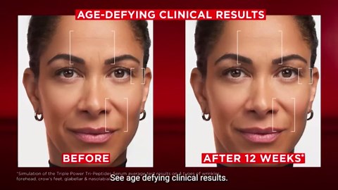 L'Oreal Paris Revitalift Triple Power Age-Defying Face Serum, Anti Aging Serum with 3 in 1 Benefits, Reduces Wrinkles, Firms and Brightens Skin, Includes Sample