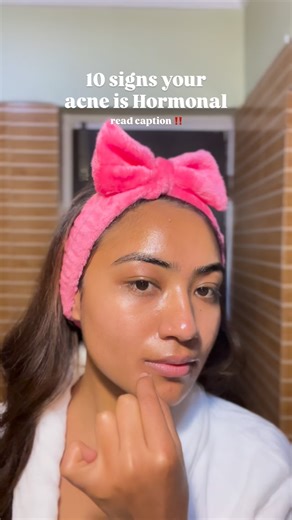 𝐃𝐫. 𝐒𝐢𝐭𝐮 𝐌𝐚𝐝𝐡𝐢𝐤𝐚𝐫𝐦𝐢 on Instagram: "If acne keeps coming back in the SAME places... it might not be your routine. Here are 10 signs your acne is likely hormone-driven: 1. It clusters around chin / jawline / lower face more than your T-zone. 2. It flares before your period or follows a monthly pattern. 3. The pimples are deep, tender, cyst-like (not just tiny whiteheads). 4. You get fewer “random” breakouts and more “same spot, same cycle.” 5. Your skin feels oilier around flares (