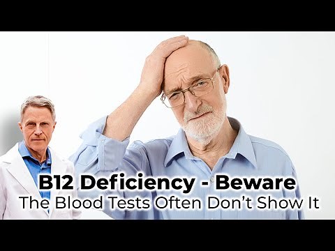 B12 Deficiency - Beware - the blood tests often don’t show it