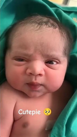 A cute newborn baby after birth c -section delivery 🥺#shorts