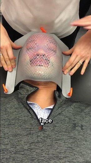 How a Thermoplastic Mask Protects Patients in Seconds!