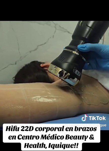 ✨ REAFIRMA TUS BRAZOS SIN CIRUGÍA ✨ HIFU 22D Corporal Con el paso del tiempo la piel de los brazos puede perder firmeza y elasticidad, generando esa flacidez que muchas personas desean mejorar. En Centro Médico Beauty & Health contamos con HIFU 22D corporal, una tecnología avanzada que utiliza ultrasonido focalizado de alta intensidad para estimular la producción natural de colágeno en las capas profundas de la piel. 💎 ¿Qué beneficios ofrece? ✔️ Ayuda a mejorar la firmeza de la piel ✔️ Estimula