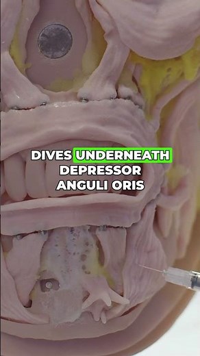 Avoid DAO complications with this injection depth.