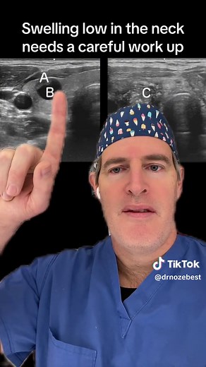 Thyroid Cancer and Neck Swelling Evaluation