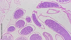 Ascaris in cross section magnified under microscope in 100 times filmed on bright field background. Macro view of parasitic worm living in human intestine and causing disease. Research of pests theme