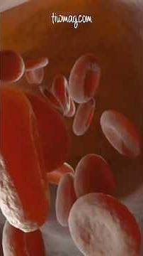 Iron Deficiency Anemia in Women Explained in 60 Seconds