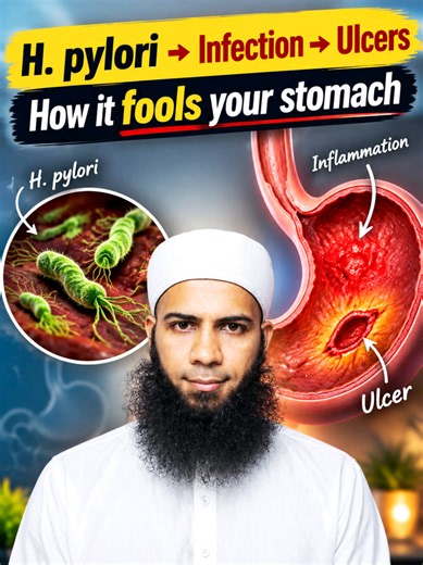 Ep 65/80 H. Pylori Explained: How This Silent Germ Causes Gastritis & Stomach Ulcers | Restores Your Gut Health Video Series . . . . #HPylori #Gastritis #StomachUlcer #GutHealth #HelicobacterPylori