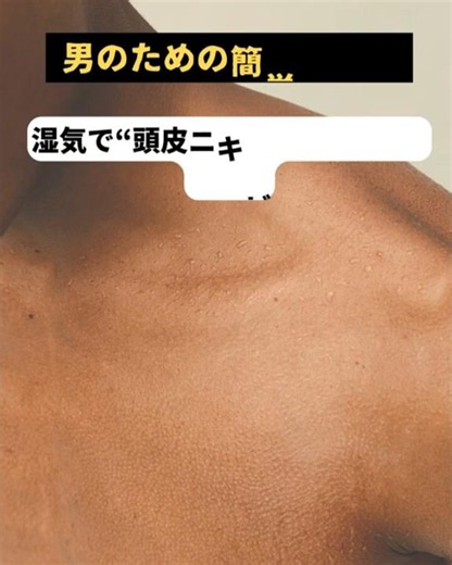 メンズ美容355 “湿気で“頭皮ニキビ”が増える時期！？" （～男性の、男性による、男性のための～） #美容 #乾燥ケア #スキンケア