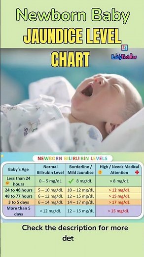 Newborn Bilirubin Levels SAFE or DANGEROUS | Normal Range & Treatment Chart | नवजातशिशु पीलिया
