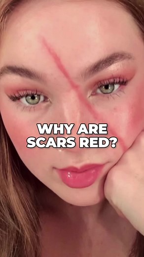 Understanding the Phases of Wound Healing