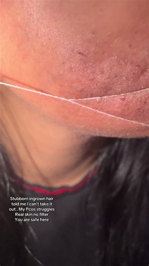 Pcos_babe (@pcos_babe)’s video of threading