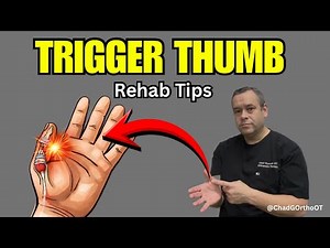 How to Treat Trigger Thumb | Rehab Tips