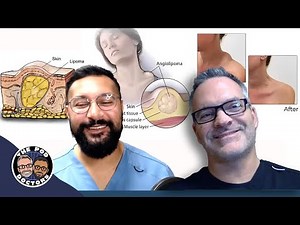 Lipoma Excision Surgery