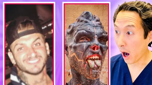 Plastic surgeon explains extreme body modification trends