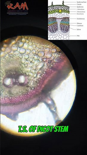 Anatomy of Flowering Plants | Dicot Stem #class11 #biology #bdforbiology #trending #experiment