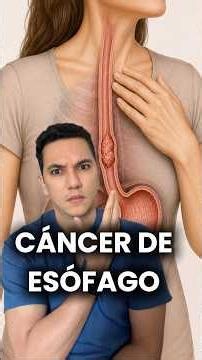 What is esophageal cancer and how common is it? #medicine #healthtips #healthandwellness #shorts