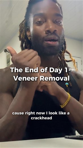 Prince Morris on Instagram: "Y’all… they had me CRYING with my top row missing 🤭 But honestly, this was the end of Day 1 and it really set the tone for everything that came after. Nerves, laughs, and trusting the process. Sometimes you have to look a little wild before things come together 😅 (FULL VIDEO ON UTUBE) #trusttheprocess #veneers #behindthescenes #dentist"