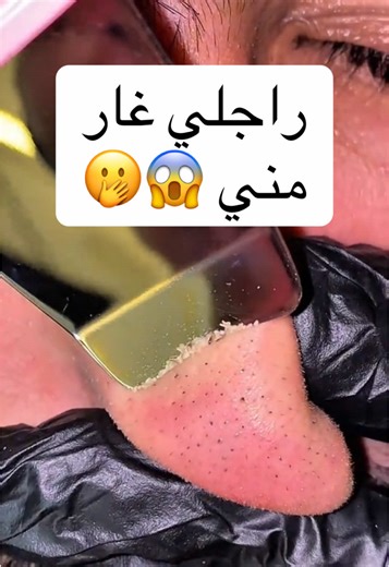 جهاز التنظيف الألتراسونيك لبشرة صحية