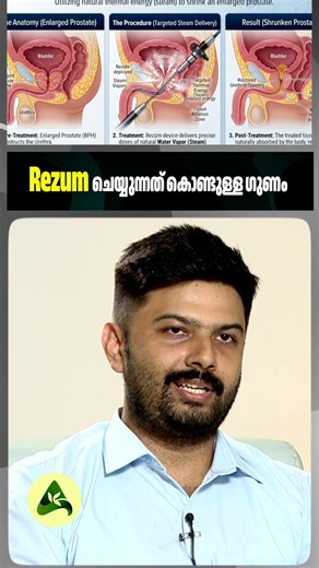 Rezum ചെയ്യുന്നത് കൊണ്ടുള്ള ഗുണം #EnlargedProstate #ProstateTreatment