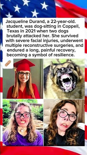 Dog-Sitting Turned Nightmare #viral #inspiration #facts #humanity #youtubeshorts #trending #survivor