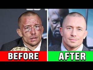 MMA Fighters That Needed Facial Surgery AFTER A Fight!