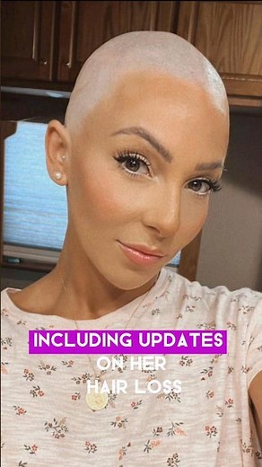 Street Outlaws Star Lizzy Musi passed away at the age of 33🕊❤️