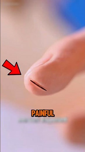 Why Do Paper Cuts Hurt SO Much?! 😱