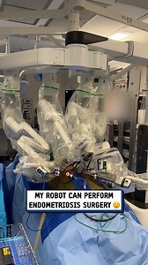 Doctors can control these robots for surgery miles away 🤖🩺 #medical #robot #doctor | UNILAD Tech