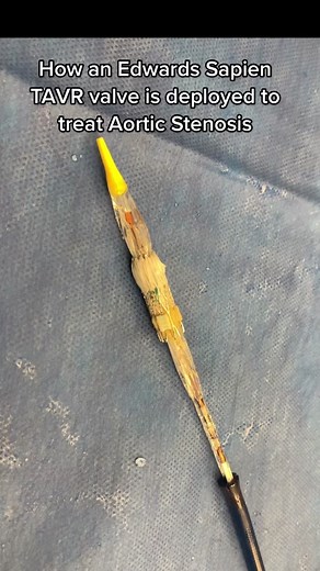 How a Sapien TAVR is deployed to treat severe aortic stenosis #tavr #medicine #learnontiktok #medtok #cardiology #science #medtech