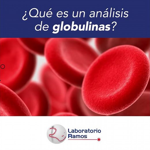 ¿Qué es un análisis de globulinas?