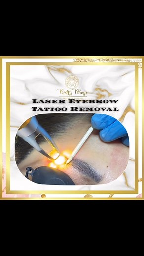 ✨Laser Eyebrow Tattoo Removal Do it now! Lessen your eyebrow regrets! Dm us for more info 🤳 | Pretty Please Aesthetic Goddess International