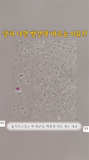 상처나면 빨간약 바르는 이유!! #웃긴짤 #fyp #웃긴영상 #좋아요폭탄 #