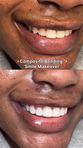 Pro Dental Clinic London