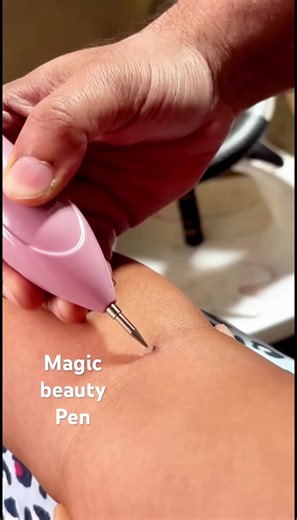 Safe Tattoo Removal Tips for Everyone