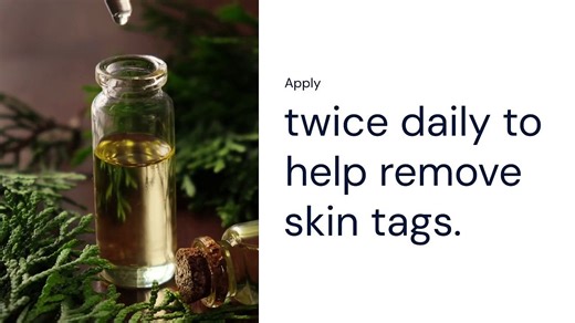 How Do I Remove a Skin Tag on My Eyelid?