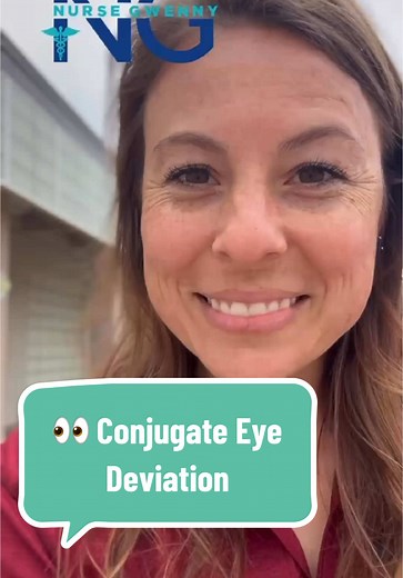 Understanding Conjugate Eye Deviation in Patients