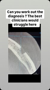 20K views · 61 reactions | What’s the diagnosis ?? Answer at end of...