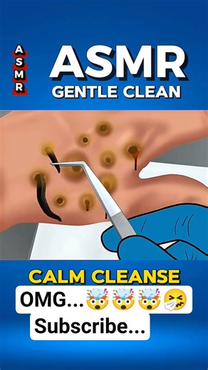 ASMR Deep Clean🤯: Satisfying Hand Extraction (Calm & Gentle) 🧼