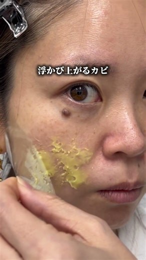 カビの退治方法まとめてみました✨肌綺麗にしたい人は注目です🫶#katan #針美容液 #カタンダーマヒットセラム #エイジングケア #美容 PR